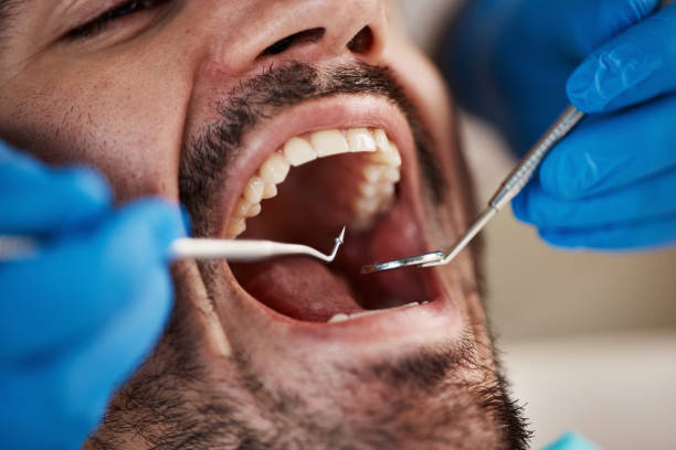 Best Pediatric Emergency Dentist in Nampa, ID